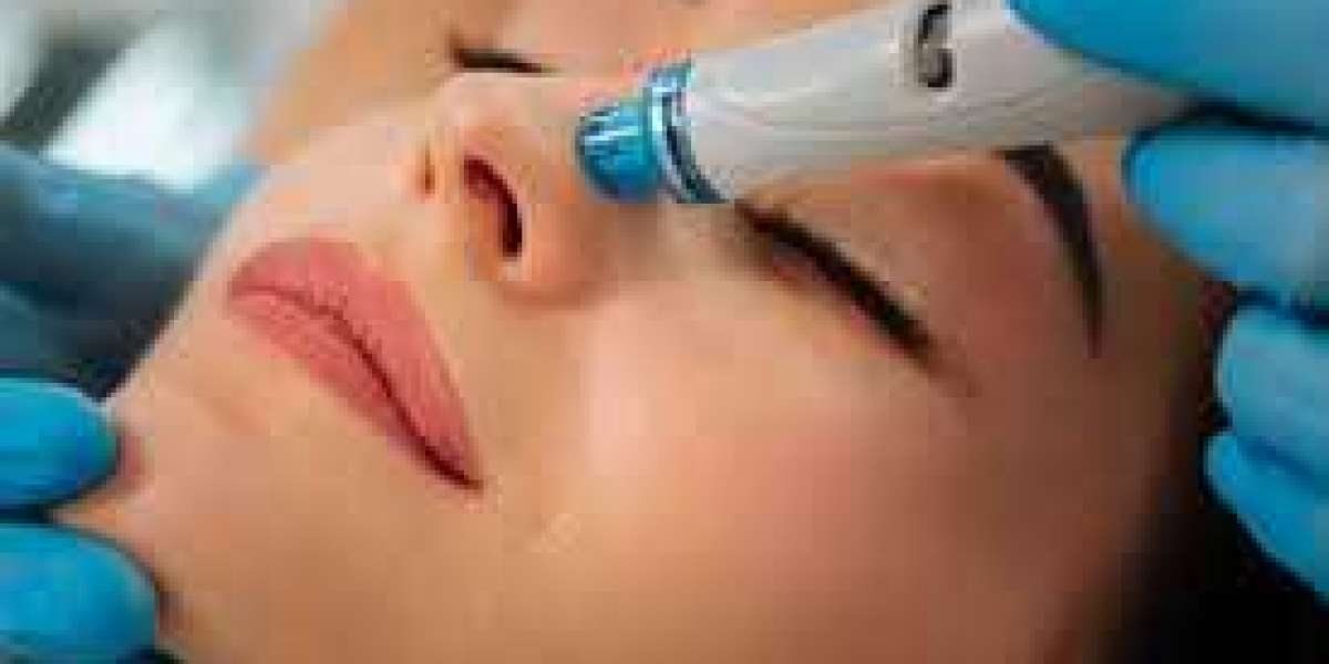 A Thorough Guide to Hydrafacial in Dublin: Benefits, Procedure, and What to Expect