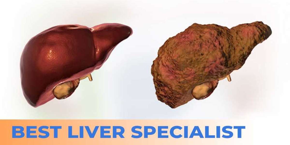 Best Liver Specialist in Noida - Jaypee Hospital