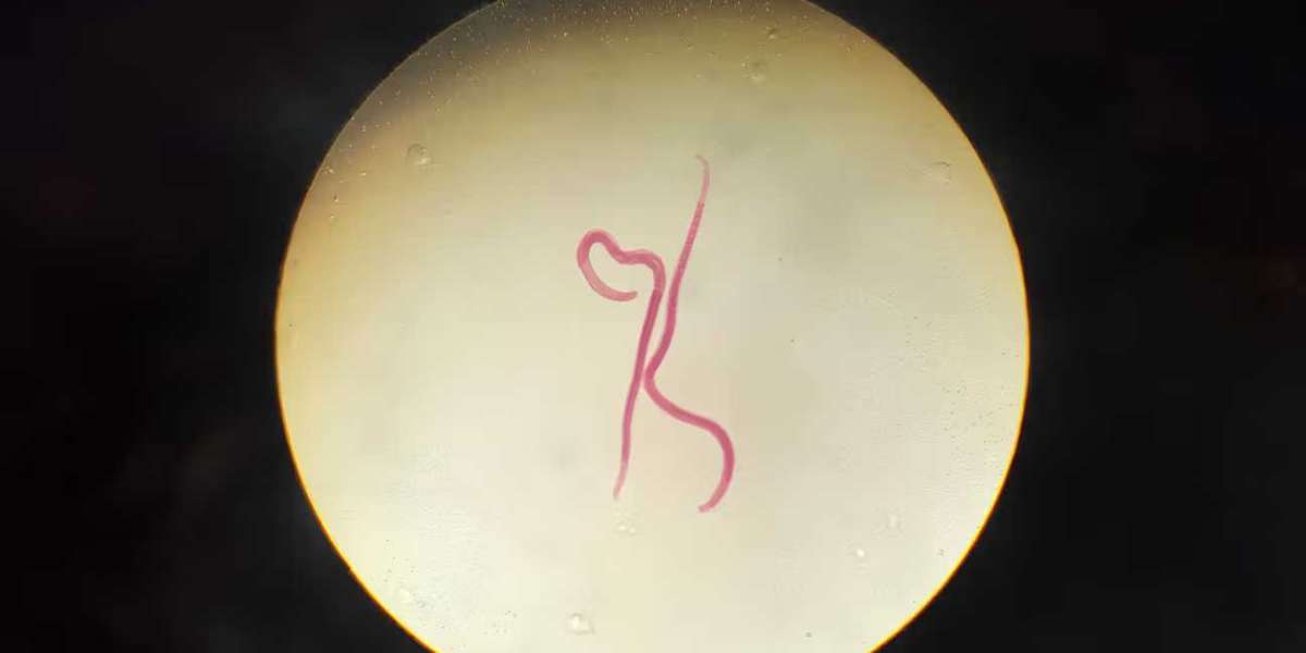 How Can Parasitic Worm Infections Be Diagnosed?